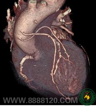 ��Ժ����������˫ԴCT��ʽͶ��ʹ��