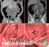 ��Ժ����������˫ԴCT��ʽͶ��ʹ��