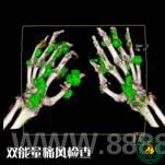 ��Ժ����������˫ԴCT��ʽͶ��ʹ��